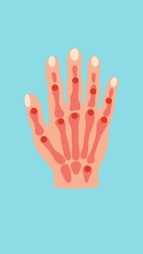 Hand bones anatomy animation Stock Footage 340956170