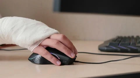 Hand in cast uses mouse Stock Footage 148224953
