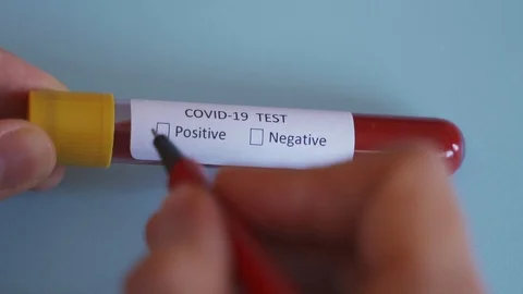 Hand checking the box Positive result on Test vial with. COVID19 Stock Footage 127240064