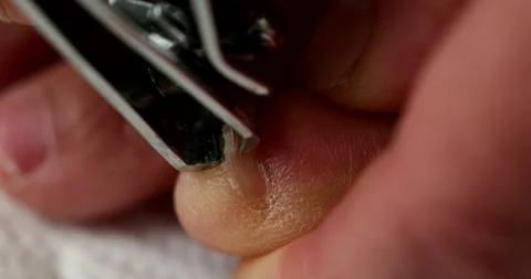 Hand Clipping Toenails Stock Footage 140628158