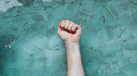 Hand is compressed so much that is bleeding Stock Footage 68638181
