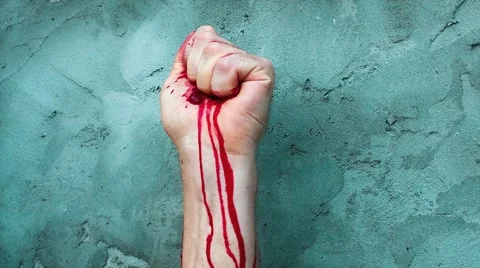 Hand is compressed so much that is bleeding Stock Footage 68638183