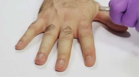 Hand Depilation Time Lapse Stock Footage 10880790