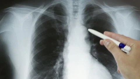Hand of a doctor analyzi Stock-Footage 284238485