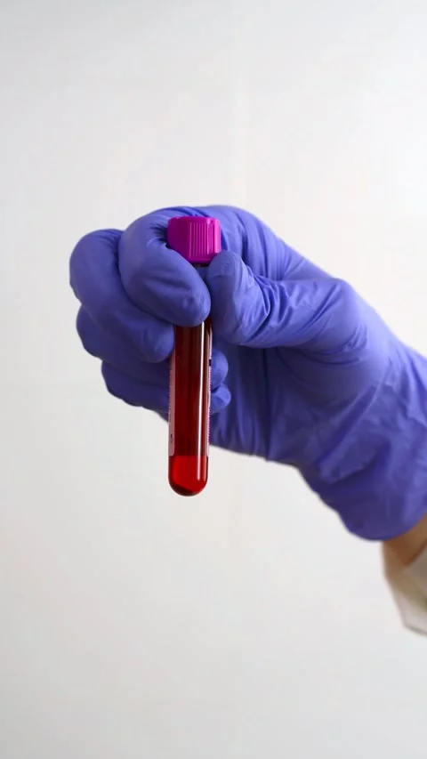 Hand of a doctor with blood sample Stock Footage 276237256