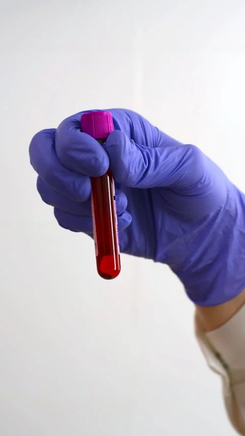 Hand of a doctor with blood sample Stock Footage 276237268