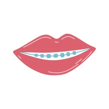 Hand drawn lips with teeth and braces in cartoon flat style. Vector illustration Stock Illustration