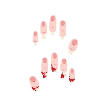 Hand drawn vector illustration of finger cut off with exposed bone. Stock Illustration