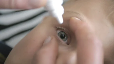 Hand dripping eye drops in child eyes. Allergy and conjunctivitis treatment. Video stock 158314383