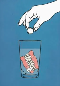 Hand dropping denture cleaner tablets into glass of water with dentures Stock Illustration