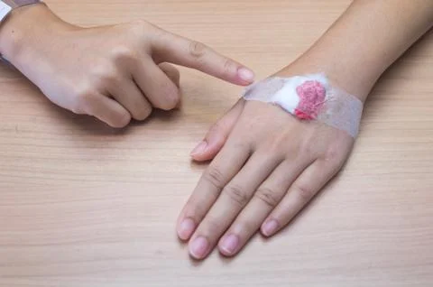 Hand with gauze Stock Photos