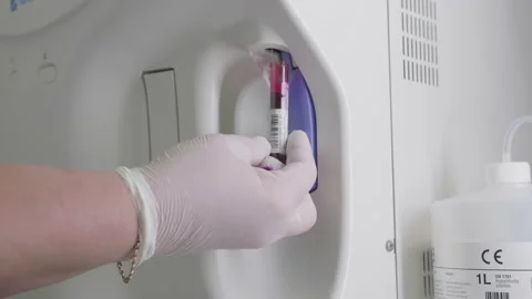 Hand in Glove Placing Test Tubes Into analyzer. Advanced Scientific Lab for Stock Footage 168350101