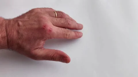 Hand with Gold Ring Resting on White Surface Showing Knuckle Marks Video stock 330450934