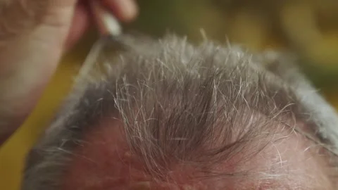 Hand-held Ayurvedic relaxing head massager (1) Stock Footage 298907358