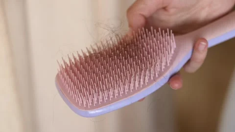 Hand holding brush covered with fallen hair strands, noticeable hair loss Stock Footage 321819456