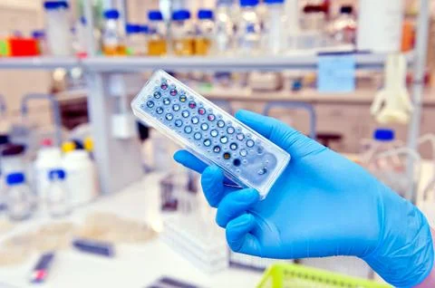 Hand holding detection of bacteria test 写真素材