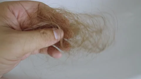 Hand holding drop down hair. Lots of fallen hair. Hair loss problem. Stock Footage 237697995