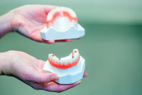 Hand holding a set of dentures Stock Photos