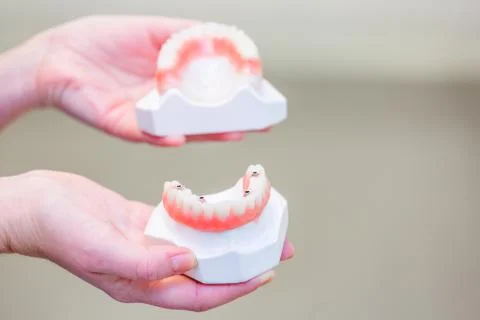 Hand holding a set of dentures Stock Photos