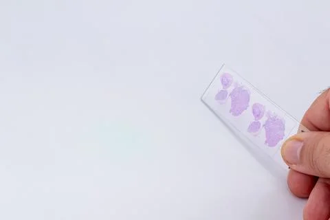 Hand holding stained microscope slide on white background, pathology sample.. Stock Photos