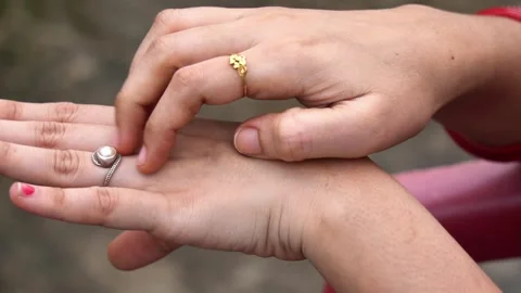Hand Itching After Mosquito Bite. Stock Footage 339494537