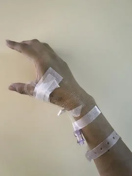 Hand with IV set,showing how to use the medical healing Foto stock