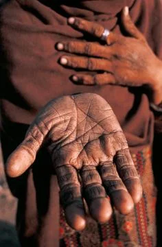 Hand of a low caste woman ( India) Stock Photos