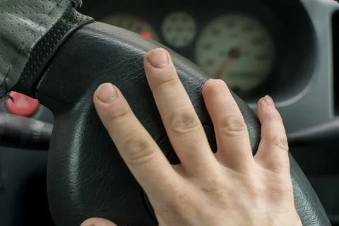 Hand of a man with a missing finger phalanx Foto stock