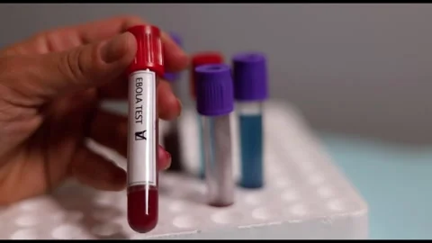 Hand Marking Ebola Blood Sample Tube with Permanent Marker Stock Footage 335658900