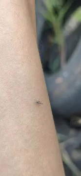 A hand from a mosquito bite. Mosquito drinks blood on the arm. Stock Photos