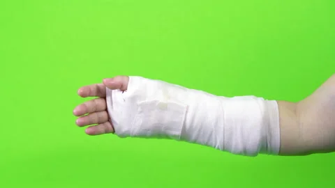 Hand moving and splint isolated on green screen background Video stock 235415029