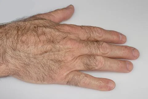 Hand of old man with problem de health. Stock Photos