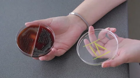 Hand with Petri dish shows visible bacterial culture Stock Footage 48106778