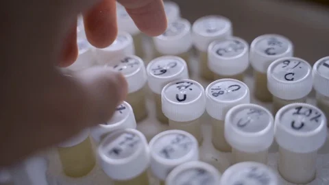 A hand picks out a sample for a test in a laboratory Stock Footage 112503864