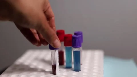 Hand Placing Hantavirus Blood Sample Tube Into Lab Rack Stock Footage 335658908