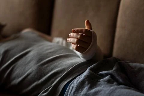 Hand in a plaster cast Stock Photos