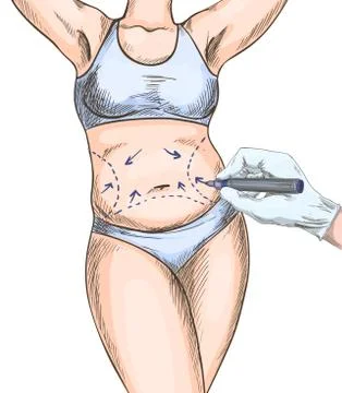 Hand of plastic surgery drawing marks on female Stock Illustration
