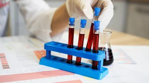 Hand of a scientific taking a blood sample tube from stand Stock Photos