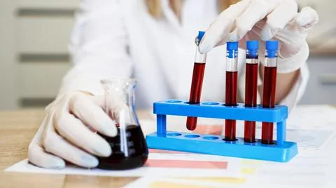 Hand of a scientific taking a blood sample tube from stand Stock Photos