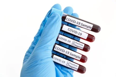 Hand of Scientist working in Lab while Checking Result of Blood Sample testin Stock Photos