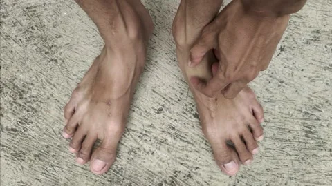 Hand Scratching Itchy Foot Stock Footage 299468378