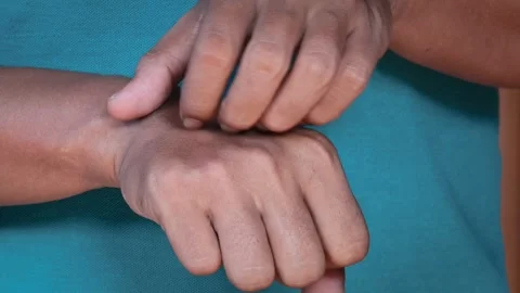 Hand Scratching itchy wrist Stock Footage 335867571
