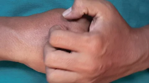 Hand Scratching itchy wrist Vidéo 335867579