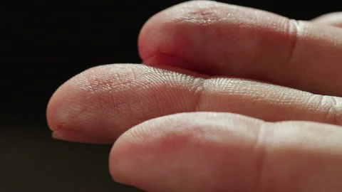 Hand skin texture close-up. Arm surface macro shooting. Body and healthcare Stock Footage 170162896