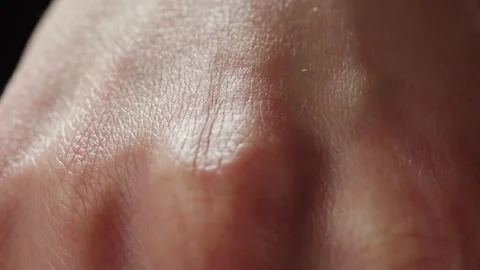 Hand skin texture close-up. Arm surface macro shooting. Body and healthcare Stock Footage 170586146