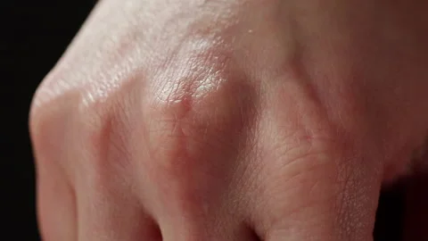 Hand skin texture close-up. Arm surface macro shooting. Body and healthcare Stock Footage 170587483