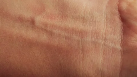 Hand skin texture close-up. Veins on hand. Healthcare, medicine concept. Stock Footage 313295480