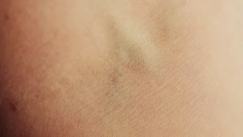 Hand skin texture. Macro shot of human veins. Body and health concept. Stock Footage 318904299