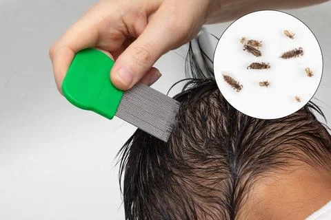 Hand using nit comb on hair removing head lice Photos