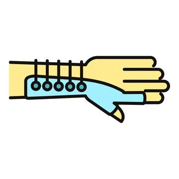 Hand wearing an external fixator for bone healing Stock Illustration